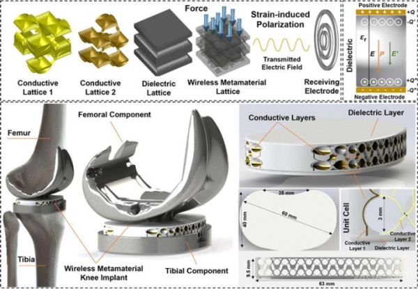 Инженеры-строители помогли создать первые в мире автономные датчики для лечения позвоночника Инженеры-строители помогли создать первые в мире автономные датчики для лечения позвоночника